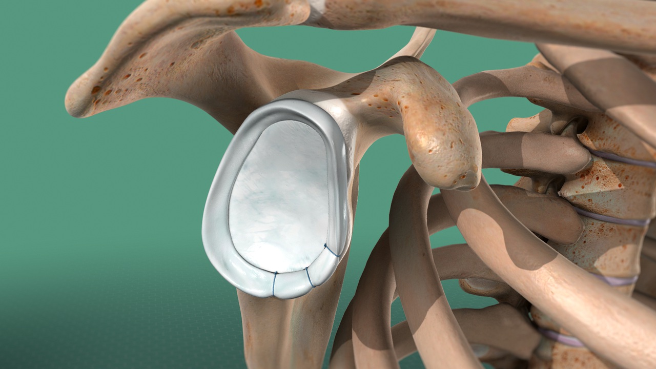 Robotic Surgery in Electronic City