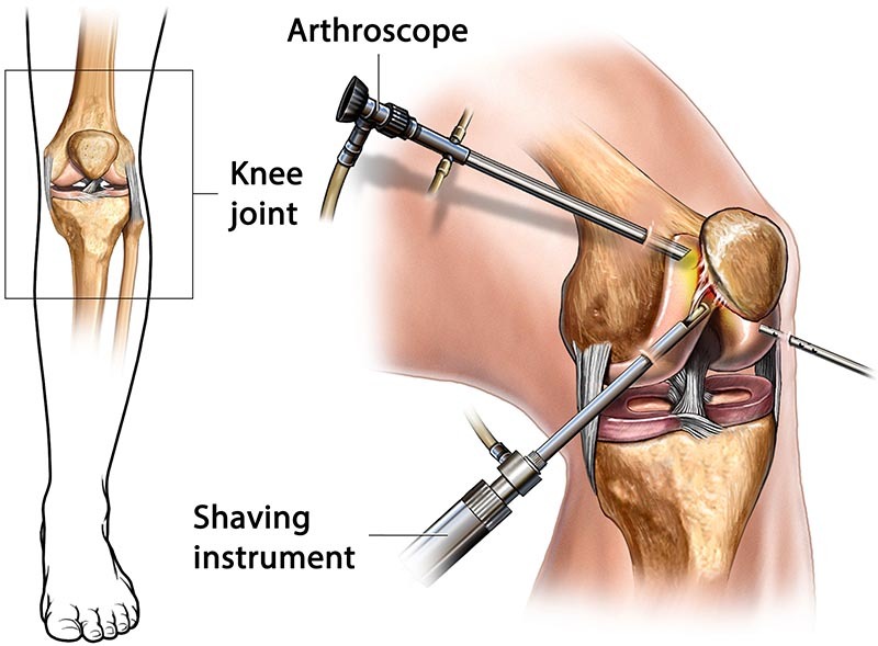 Robotic Surgery in Electronic City