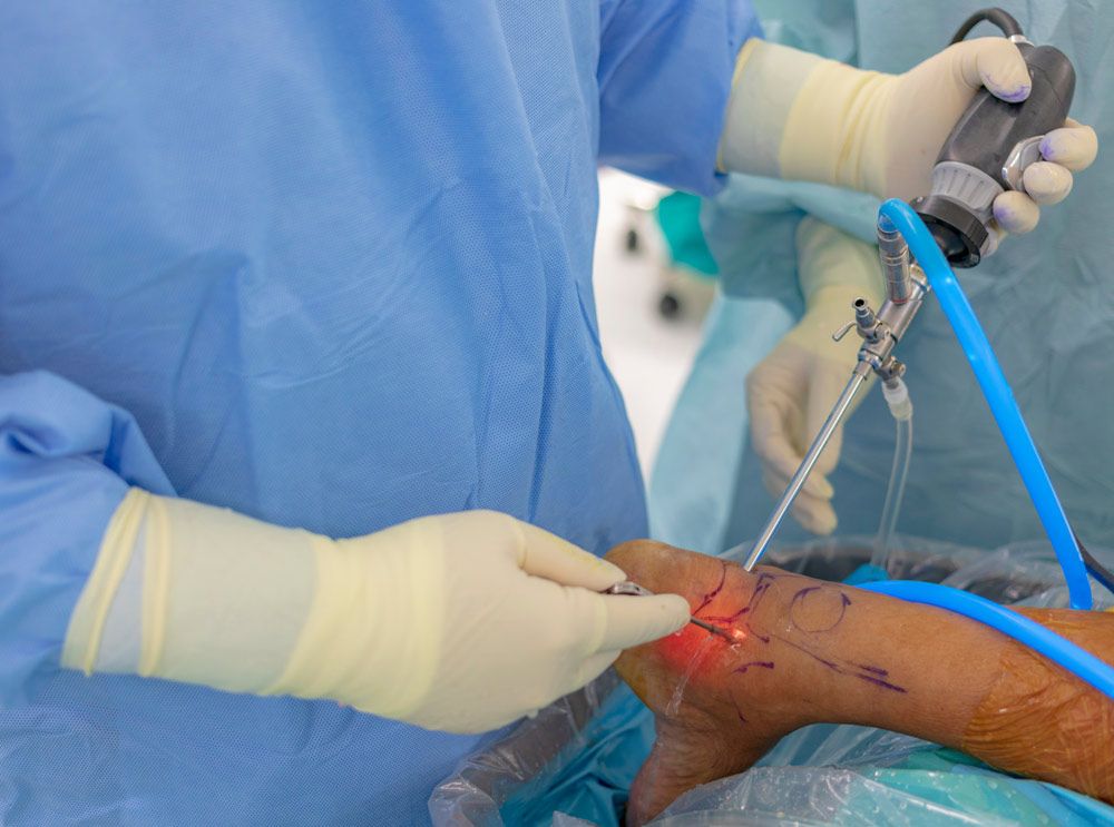 Robotic Surgery in Electronic City