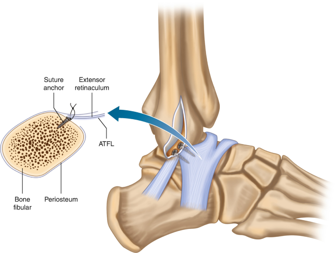 Robotic Surgery in Electronic City