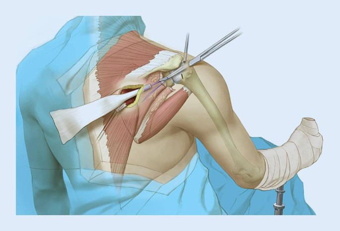 Service Image