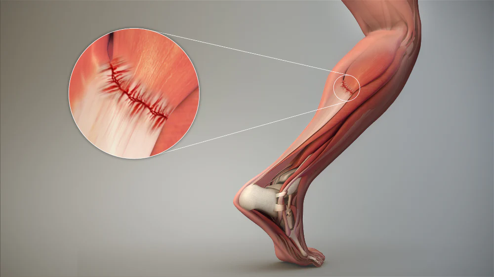Robotic Surgery in Electronic City