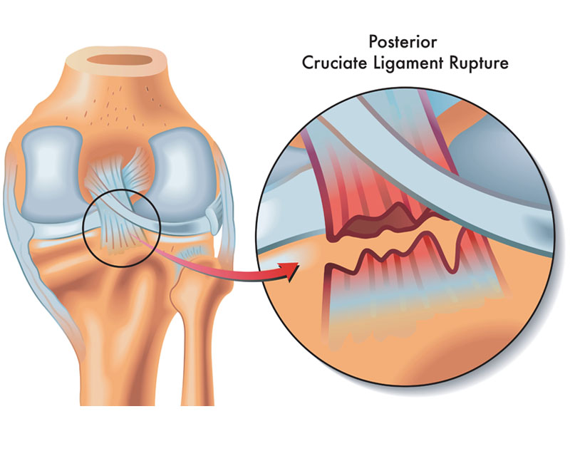 Robotic Surgery in Electronic City