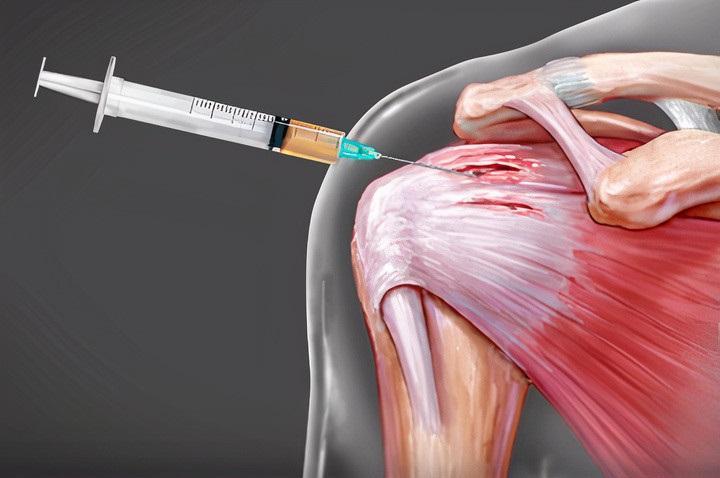 Robotic Surgery in Electronic City