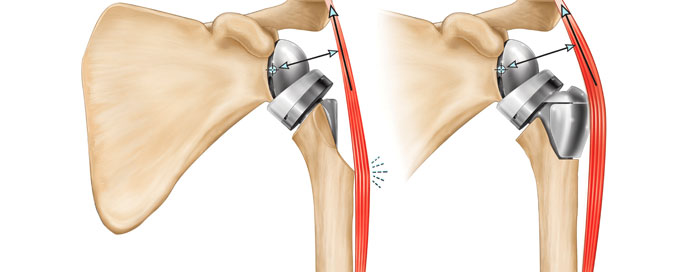 Robotic Surgery in Electronic City