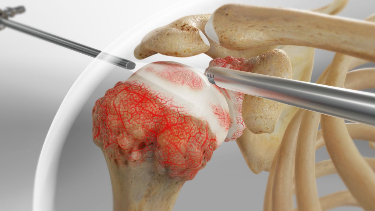 Robotic Surgery in Electronic City