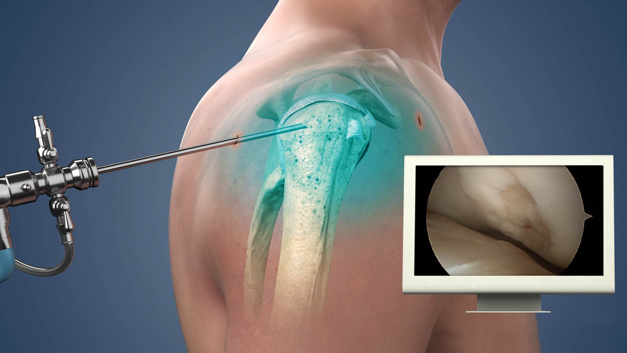 Robotic Surgery in Electronic City