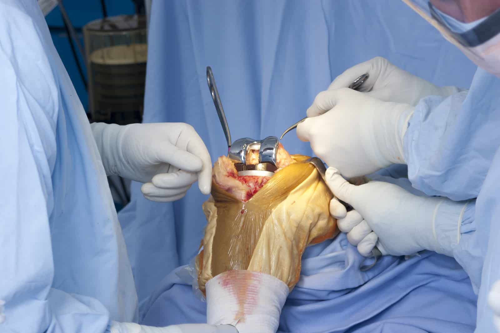 Robotic Surgery in Electronic City
