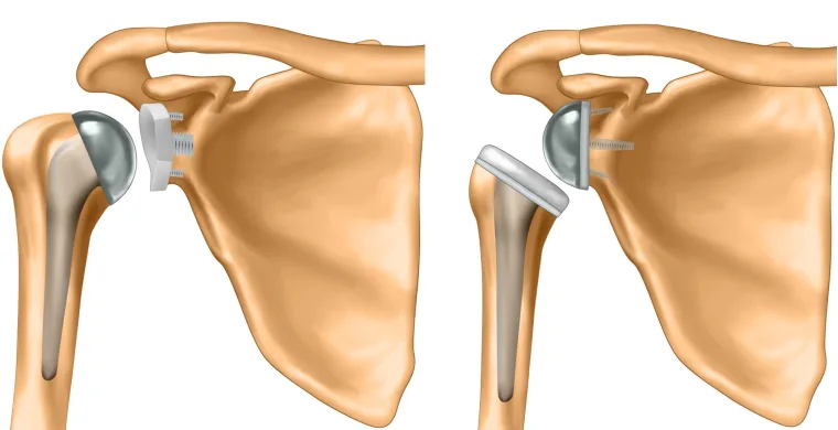 Robotic Surgery in Electronic City